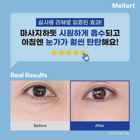 멜라트 어글로우 롤 온 아이 세럼 / 레티놀 아이크림 눈가주름 팔자 다크... 솔직 후기 | 피부 타입별 분석 - 상품 이미지 2