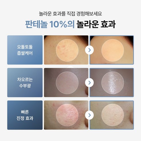 투데이위드 소프트 모이스쳐 판테놀 10% 속보습 수분크림 솔직 후기 | 실사용자 리뷰 분석 - 상품 이미지 2