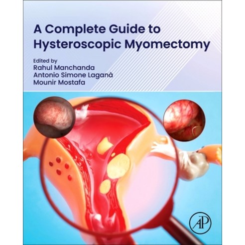 (영문도서)A Complete Guide to Hysteroscopic Myomectomy Paperback, Academic Press, English, 9780443366703