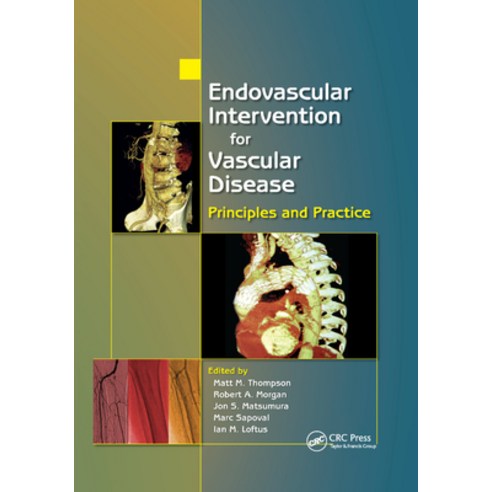 (영문도서)Endovascular Intervention for Vascular Disease: Principles and Practice Paperback, CRC Press, English, 9780367387907