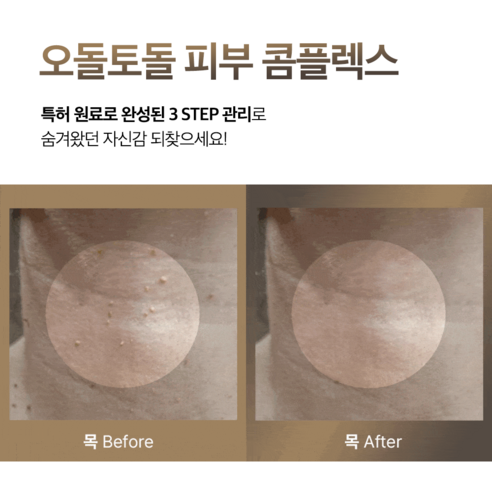 율무패치 | 에슬 스킨 플랫 패치 솔직 후기 | 실사용자 리뷰 분석 - 상품 이미지 2