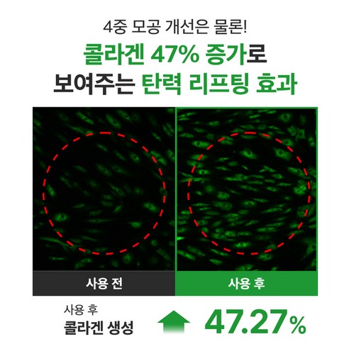 성분에디터 NMN 4중 모공 수축 앰플 40ml + 앰플 샤쉐 2g 세트 솔직 후기 | 피부 타입별 분석 - 상품 이미지 3