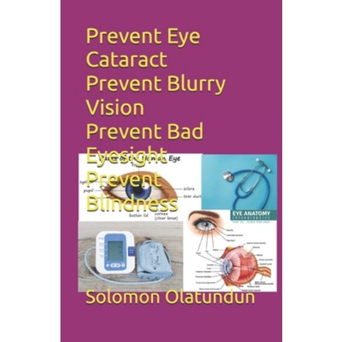 (영문도서)Prevent Eye Cataract Prevent Blurry Vision Prevent Bad Eyesight Prevent Blindness Paperback, Independently Published, English, 9798261837473