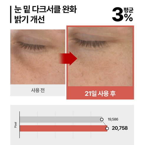 야다 하이드로겔 다크서클 눈가 눈밑주름 아이패치 링클패치 아이 마스크팩 솔직 후기 | 피부 타입별 분석 - 상품 이미지 3