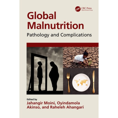 (영문도서)Global Malnutrition: Pathology and Complications Paperback, CRC Press, English, 9781032295350