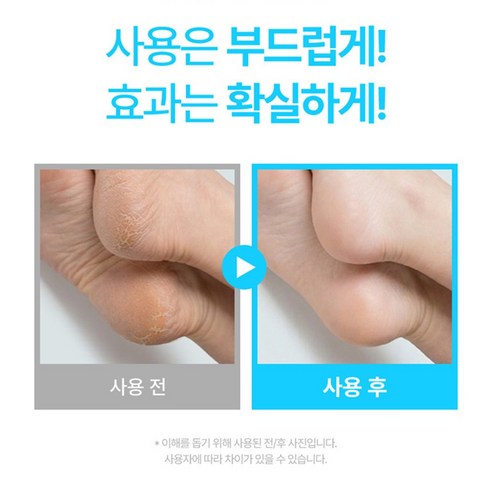 글로벌 인기템 하이브리드 고마쥬 발각질제거제 80ml 솔직 후기 | 피부 타입별 분석 - 상품 이미지 2