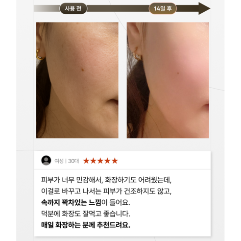 위자드조선 누룩 클렌징밀크 민감성 피부 장벽 개선 피부과입점 솔직 후기 | 피부 타입별 분석 - 상품 이미지 3
