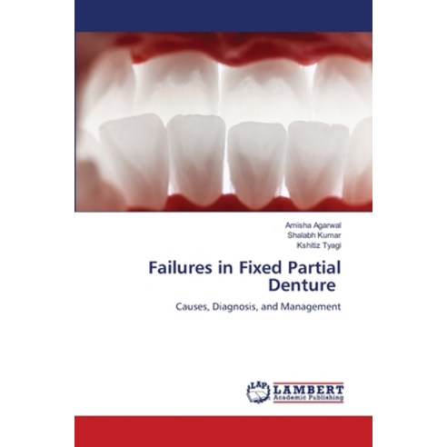 (영문도서)Failures in Fixed Partial Denture Paperback, LAP Lambert Academic Publis..., English, 9786209967238