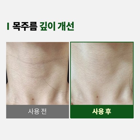 비쏠르 동안 기초세트(크림75ml+세럼50ml) 이미지 2