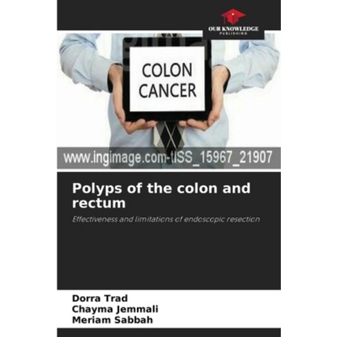 (영문도서)Polyps of the colon and rectum Paperback, Our Knowledge Publishing, English, 9786202940276