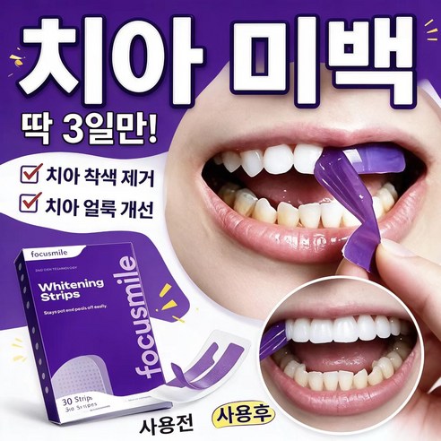 가정용 치아메이크업 보라색 미백스트립 퍼플 패치 일상 치아색상 관리 간편 부착형 치아용품, 1개