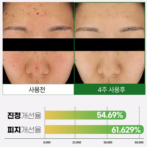 메디픽미 올그린톡스 솔루션 크림 솔직 후기 | 실사용자 리뷰 분석 - 상품 이미지 4