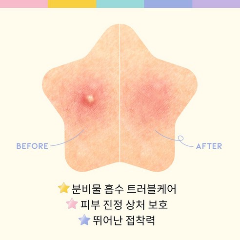 #오오티디뷰티 별모양 여드름패치 스타 스팟 패치 솔직 후기 | 실사용자 리뷰 분석 - 상품 이미지 4