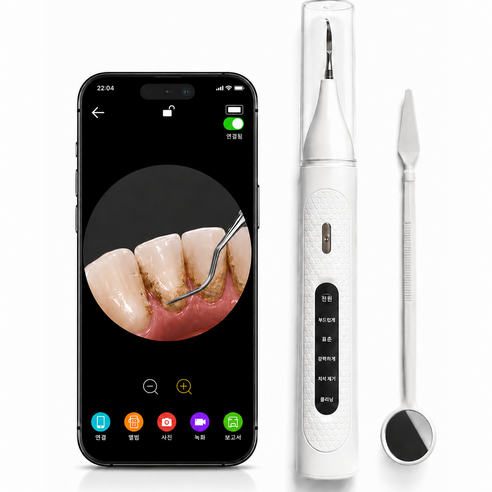 SOVI 초음파 구강 청결기 고화질 시각화 500w 고해상도 화질, 화이트, T6