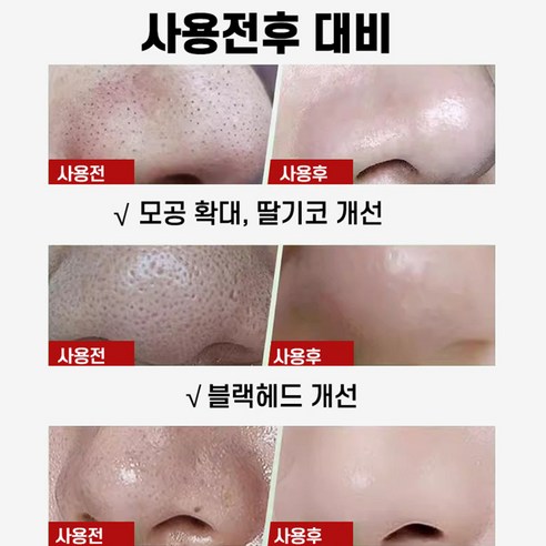 [피부과 추천] 1/1+1 블랙헤드 코팩 코 블랙헤드 제거 팩 죽탄 페이... 솔직 후기 | 피부 타입별 분석 - 상품 이미지 4