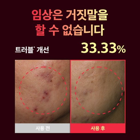 성분에디터 레드어성초 사춘기 트러블 여드름 진정 보습 병풀 수딩 앰플 솔직 후기 | 실사용자 리뷰 분석 - 상품 이미지 3