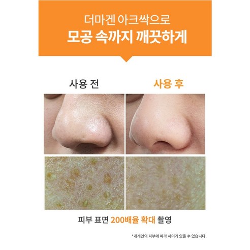 더마겐 아크싹 폼클렌징 / 기능성 여드름 세안제 솔직 후기 | 실사용자 리뷰 분석 - 상품 이미지 3