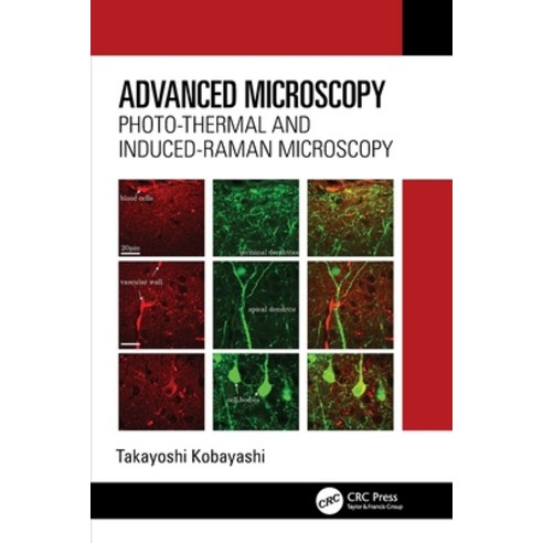 (영문도서)Advanced Microscopy: Photo-Thermal and Induced-Raman Microscopy Paperback, CRC Press, English, 9781032758862