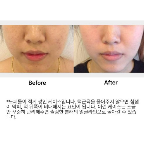 매일 나를 위한 시간, 가쏘 괄사로 뭉친 몸과 피로를 시원하게 풀어주세요.