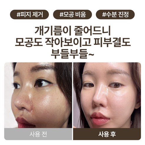 마미케어 감자 워시 오프 팩 100g 솔직 후기 | 실사용자 리뷰 분석 - 상품 이미지 3