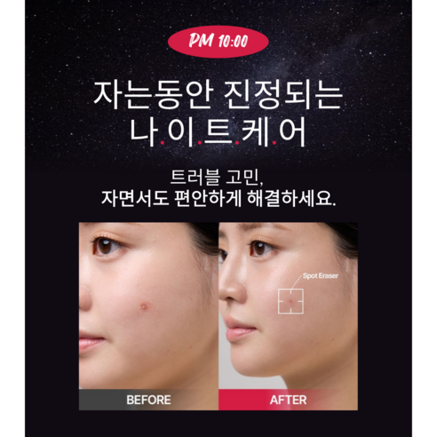 스팟이레이저 티안나는 여드름패치 스팟패치 대용량 솔직 후기 | 실사용자 리뷰 분석 - 상품 이미지 4