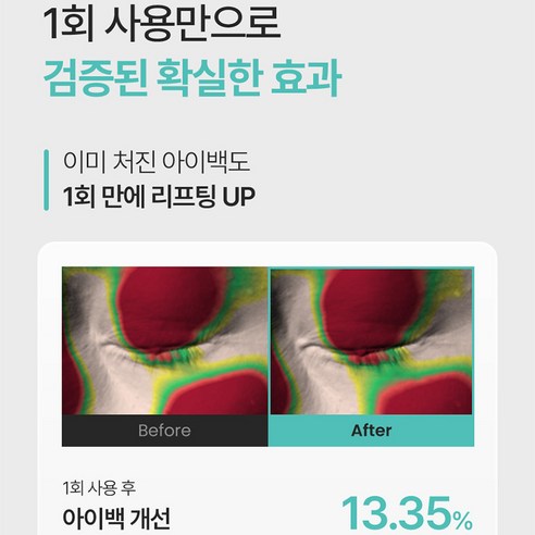 샤르드 아이백 리프트 1100샷 리들 패치 솔직 후기 | 피부 타입별 분석 - 상품 이미지 2