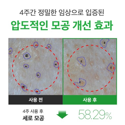 성분에디터 NMN 4중 모공 수축 앰플 40ml + 앰플 샤쉐 2g 세트 이미지 2