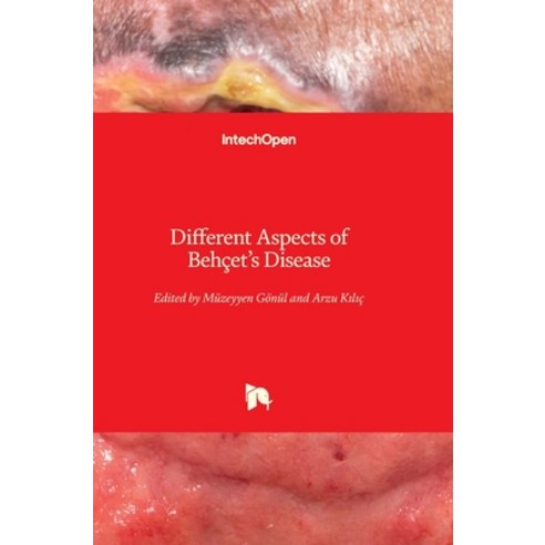 (영문도서)Different Aspects of Behçet's Disease Hardcover, Intechopen, English, 9781789856590