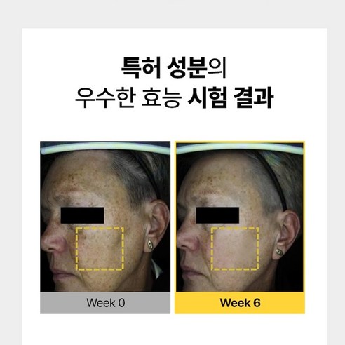 [Gift 실리콘 브러쉬 1개] 샤르드 멜라케어 필크림 마스크 솔직 후기 | 피부 타입별 분석 - 상품 이미지 2