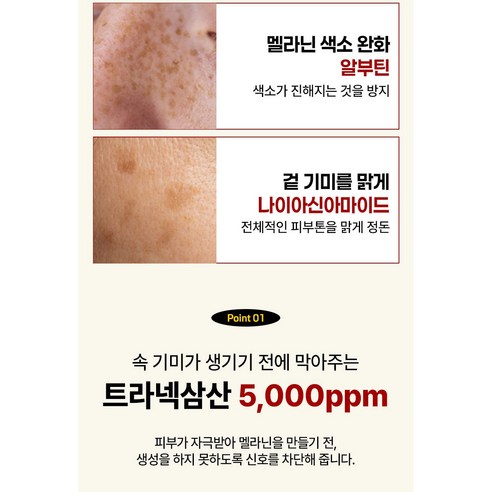[고함량 기미 억제] 기미 잡티 빅토나인 기미크림 트라넥삼산 대용량 색소침착 크림1위 이미지 3