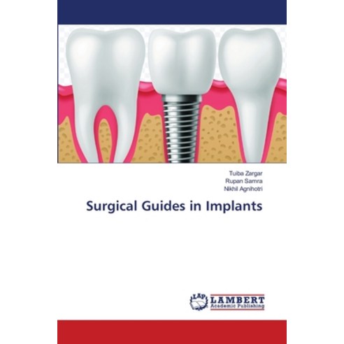 (영문도서)Surgical Guides in Implants Paperback, LAP Lambert Academic Publis..., English, 9786209998935
