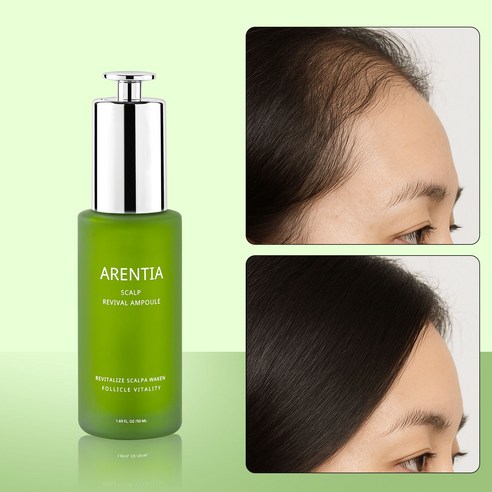 머리카락이 얇아질 때 느끼는 그 서늘함 이제 그만