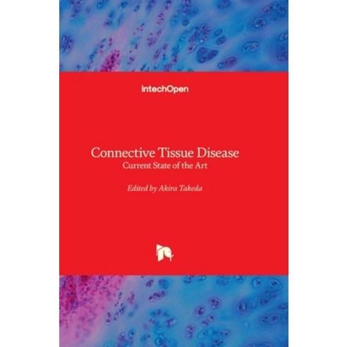 (영문도서)Connective Tissue Disease: Current State of the Art Hardcover, Intechopen, English, 9781789856989