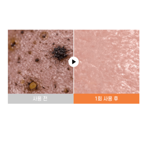 닥터멜락신 코직애씨드 터메릭 세럼 솝 클렌징 세안 비누 솔직 후기 | 실사용자 리뷰 분석 - 상품 이미지 4
