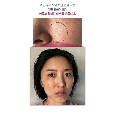 마미케어 팥 효소 클렌저 이미지 2