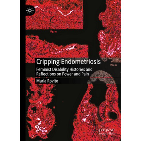 (영문도서)Cripping Endometriosis: Feminist Disability Histories and Reflections on Power a... Hardcover, Palgrave MacMillan, English, 9783032156808 Palgrave MacMillan, English, 9783032156808
