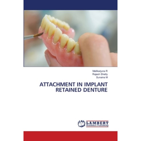(영문도서)Attachment in Implant Retained Denture Paperback, LAP Lambert Academic Publis..., English, 9786209828546