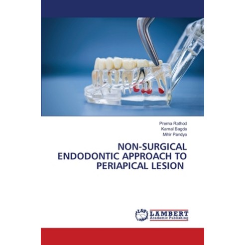 (영문도서)Non-Surgical Endodontic Approach to Periapical Lesion Paperback, LAP Lambert Academic Publis..., English, 9786630233094