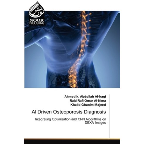 (영문도서)AI Driven Osteoporosis Diagnosis Paperback, Noor Publishing, English, 9786209917059