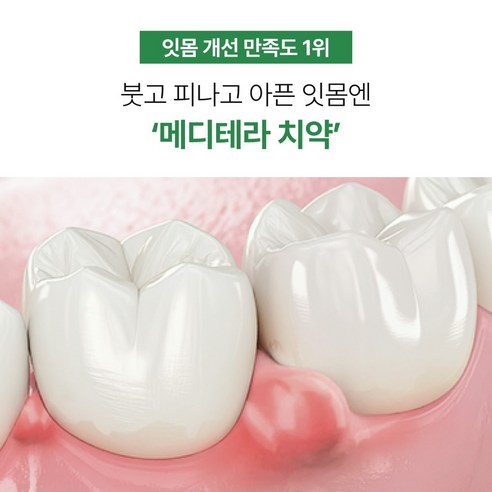 잇몸의 편안함과 상쾌함을 되찾는 계면활성제없는 특허성분 잇몸치약
