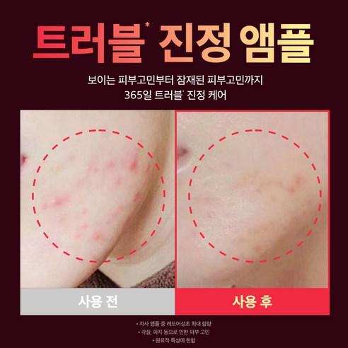 성분에디터 레드어성초 사춘기 트러블 여드름 진정 보습 병풀 수딩 앰플 이미지 2