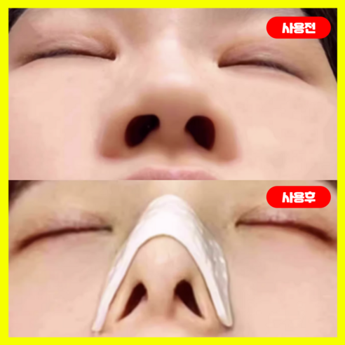 매일매일 조금씩 달라지는 나의 코, 자신감도 함께 자라나요