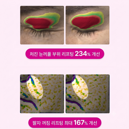 닥터멜락신 시멘리트 칼슘 볼륨 크림 솔직 후기 | 실사용자 리뷰 분석 - 상품 이미지 4