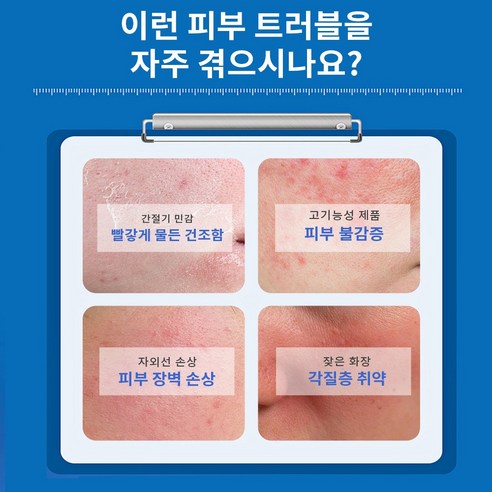 미스 매기 egf 자생크림 피부과 레이저시술 후 리페어크림 이미지 4