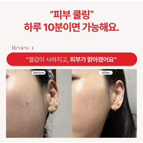 브리스킨 리얼 핏 세컨드스킨 SOS트러블케어 시트 마스크 솔직 후기 | 실사용자 리뷰 분석 - 상품 이미지 4