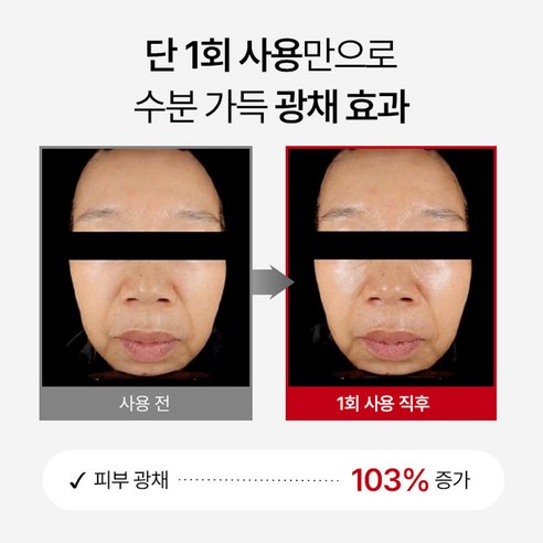메디테라피 슈마지 골드실 리프팅 크림 솔직 후기 | 실사용자 리뷰 분석 - 상품 이미지 2