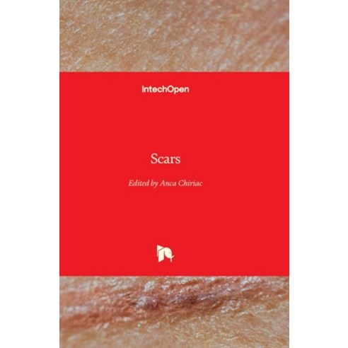 (영문도서)Scars Hardcover, Intechopen, English, 9781838809348