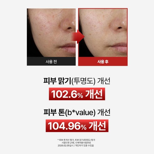 뉴이시스 트라넥삼산 필 세럼 나이아신아마이드 칙칙함 필링 이미지 2