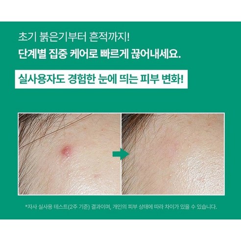 약국입점 메디케이 트러블 카밍 스팟 20ml 진정 트러블케어 솔직 후기 | 실사용자 리뷰 분석 - 상품 이미지 3