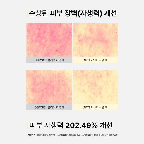 피부과 EGF 자생크림 그링드 어성초 시카 크림 레이저 시술후 점뺀후 이미지 2
